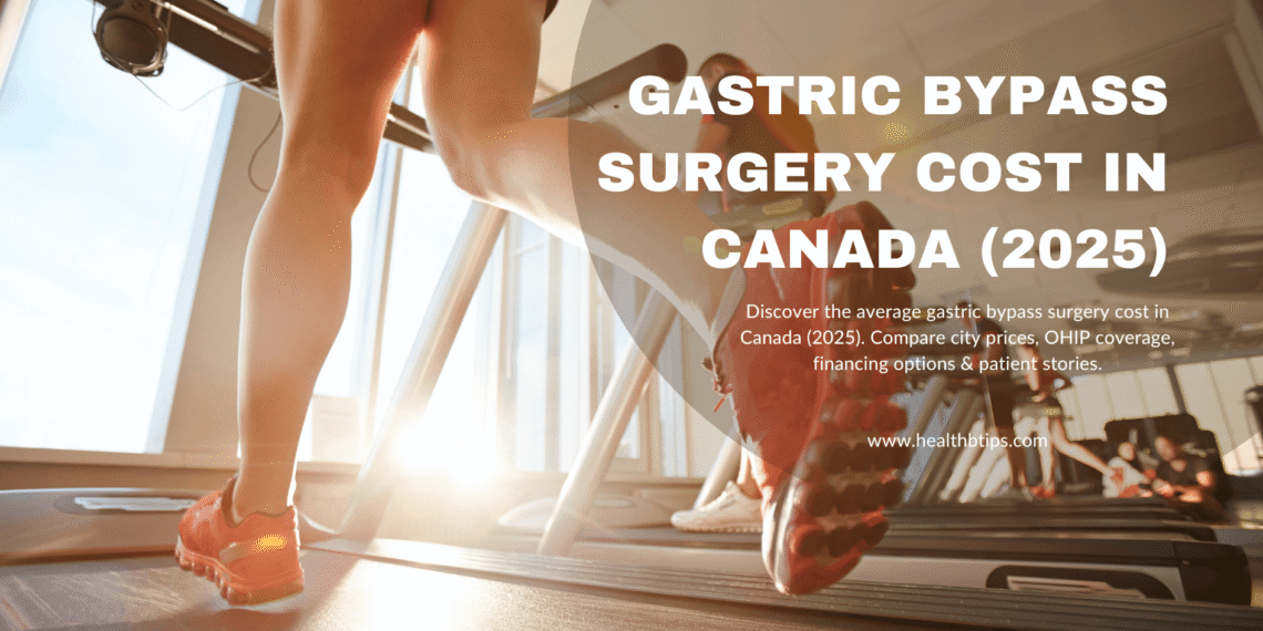 Gastric Bypass Surgery Cost in Canada 2025