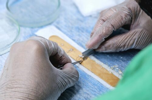 Hair Transplant Cost in 2025